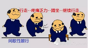 你了解“间歇性跛行综合征”吗