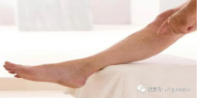 下肢深静脉血栓该如何护理？