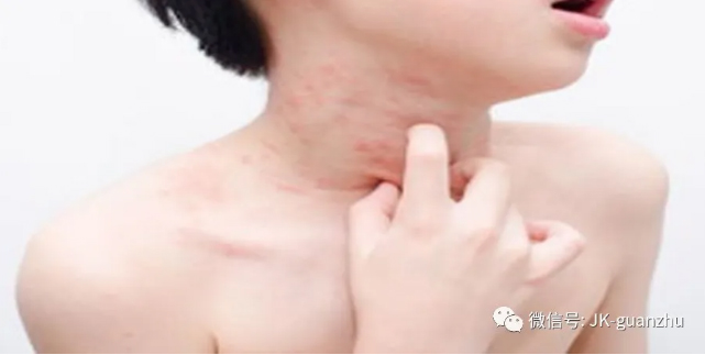注意：这6种皮肤病与情绪有关！