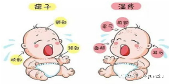 湿疹和痱子的区别是什么？