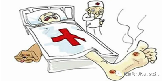 糖尿病足有多可怕