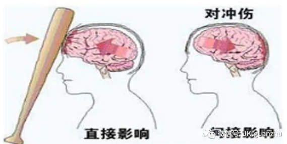 颅脑损伤后如何做好护理？