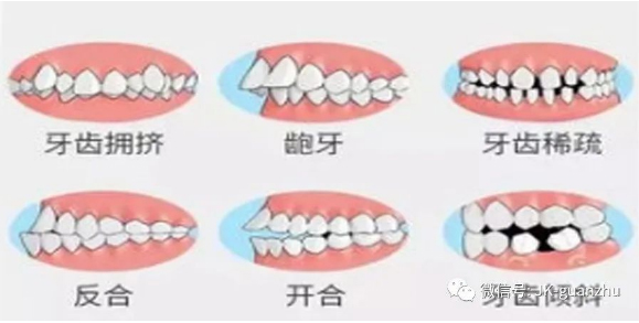 整齐洁白的牙齿，能提升自身颜值