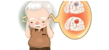 为什么脑梗死的人越来越多？